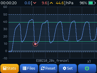 Frenzel pressure curve