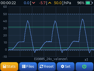 Valsalva–Frenzel pressure curve