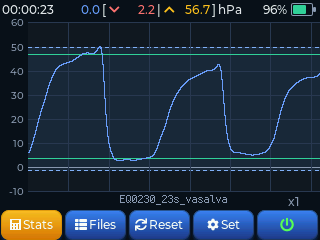 Valsalva pressure curve